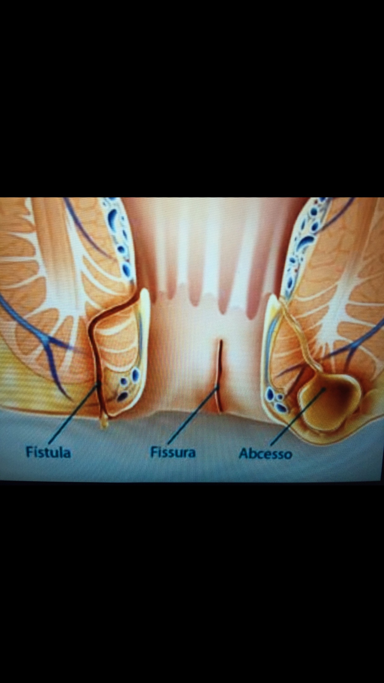 anatomia do ânus e do canal anal