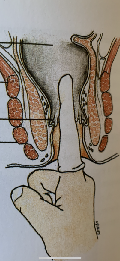 anus e canal anal