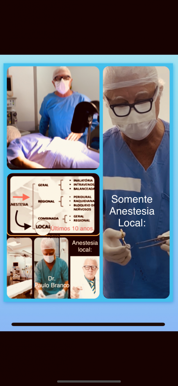 anestesia local para hemorroidas