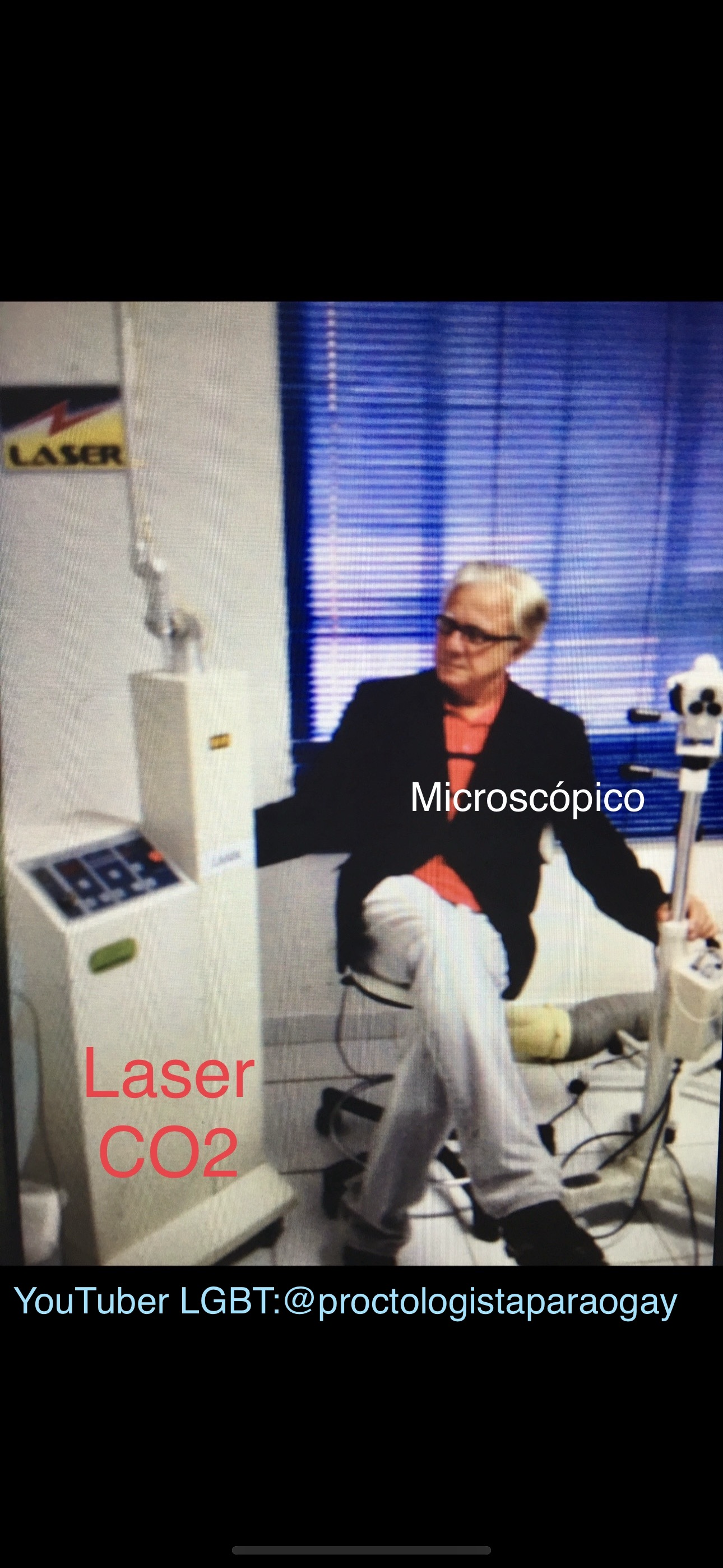 cirurgia de fistula perianal com laser 